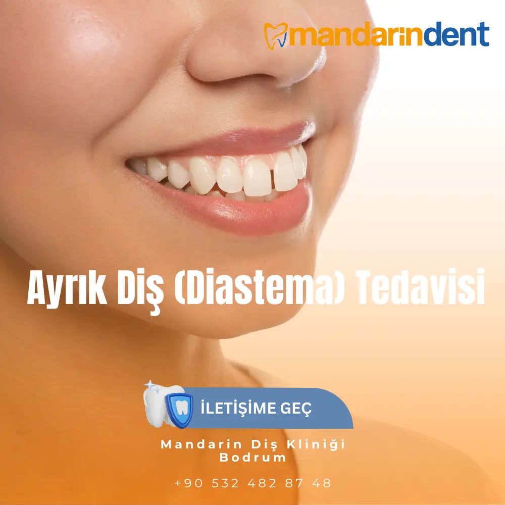 çarpık diş düzeltme telsiz