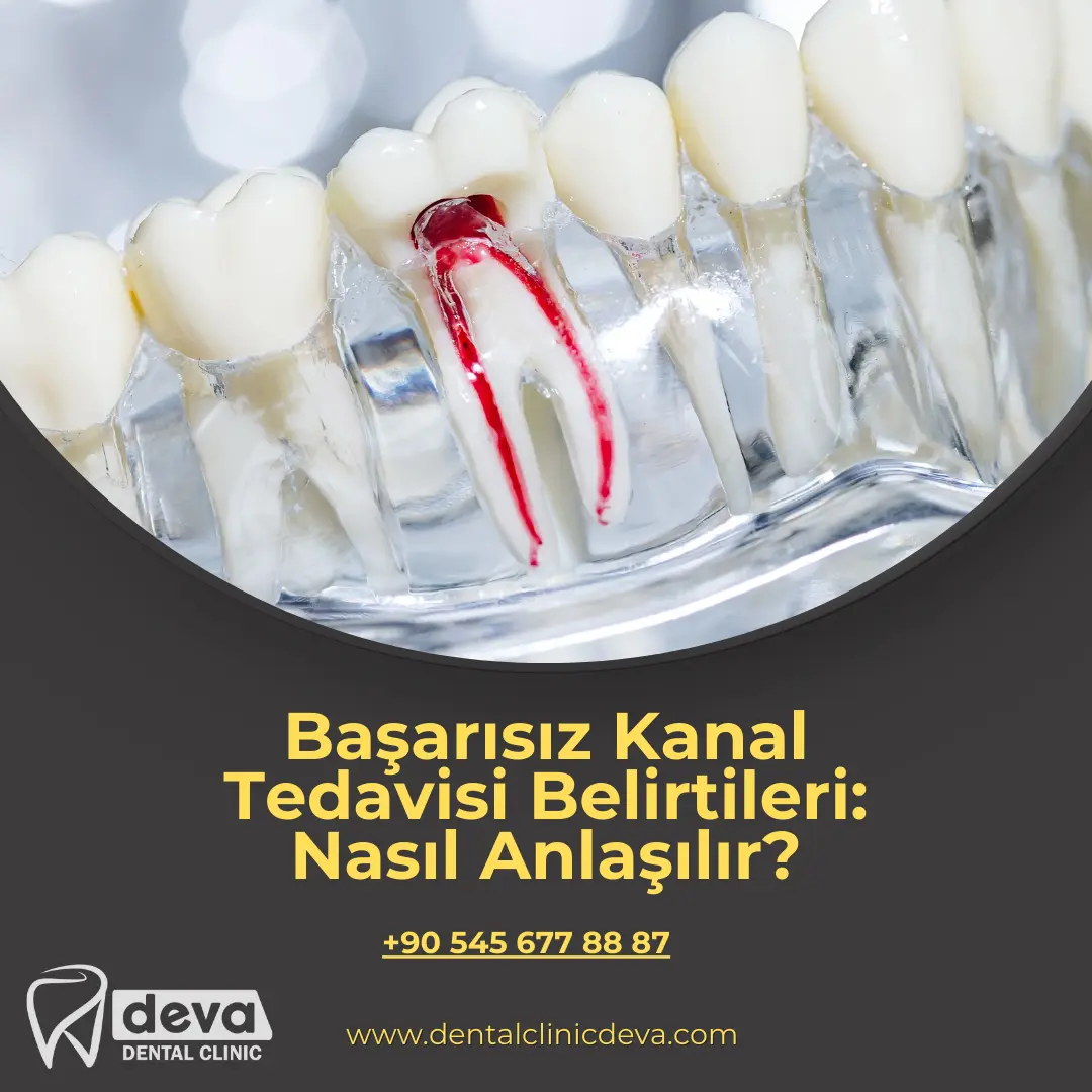  implant sonrası nelere dikkat edilmeli