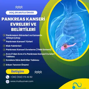 “Pankreas Kanseri Evreleri ve Belirtileri – Pankreas kanserinde erken ve ileri evreler, TNM evreleme sistemi, belirtiler, sarılık, karın ve sırt ağrısı, kilo kaybı, yeni başlayan diyabet gibi bulguların evrelere göre değişimi ve erken tanının önemi.”