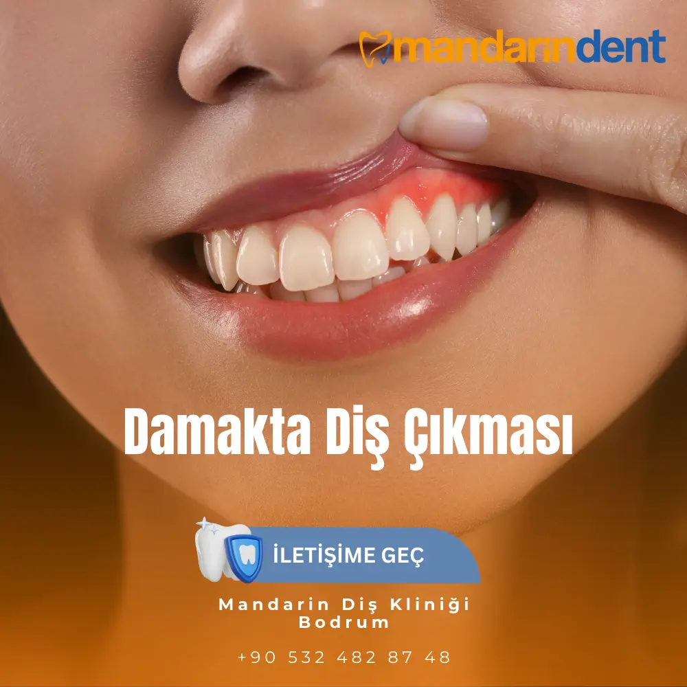  En İyi Diş Kliniği  diş ağrısına ne iyi gelir