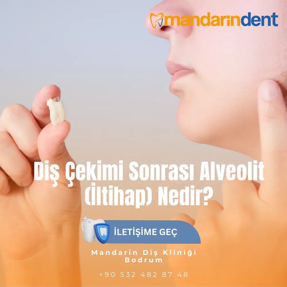 diş apsesi antibiyotikle kaç günde geçer