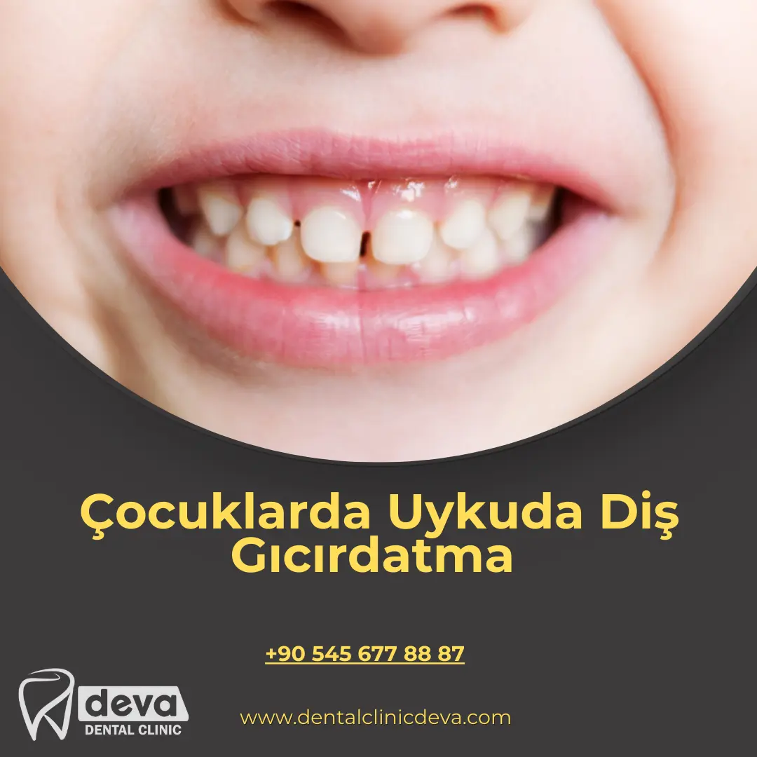 alveolit görüntüsü