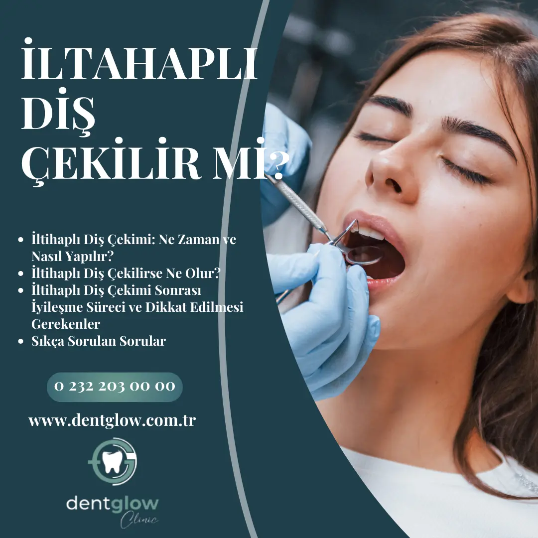 diş çekiminden sonra kuru soket belirtileri