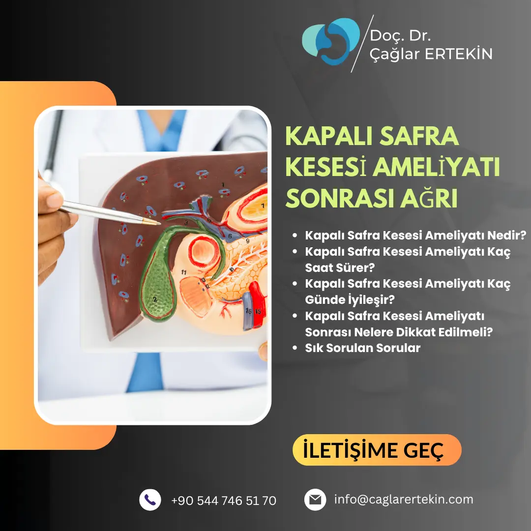 safra kesesi hastalıklarının belirtileri