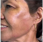 Before and After Template (11)_edited.jpg