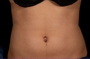 trusculptflexabs1.jpeg