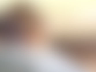 Cada año se reportan en Perú unos 15,000 casos de niños quemados
