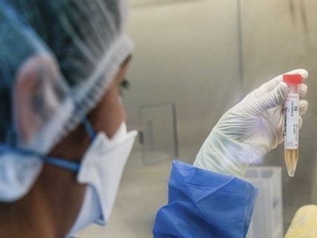 Ayacucho se prepara para analizar muestras de posibles casos de enfermedad