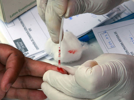Segundo caso mundial de "curación" de paciente con el virus del sida
