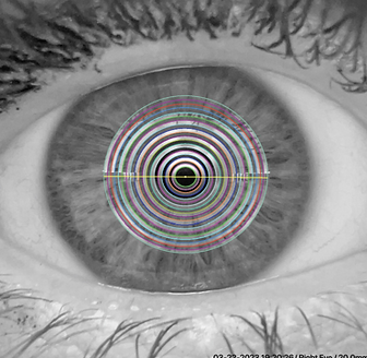 High definition image of the eye