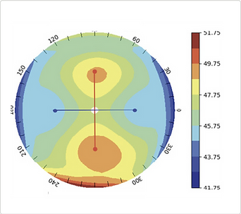 Heat map of eye measurements