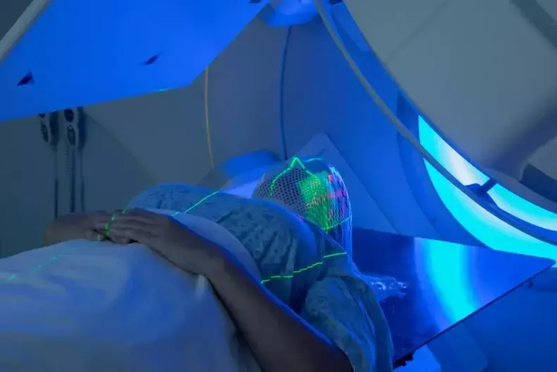 Cuidados com a Pele na Área Irradiada Durante a Radioterapia