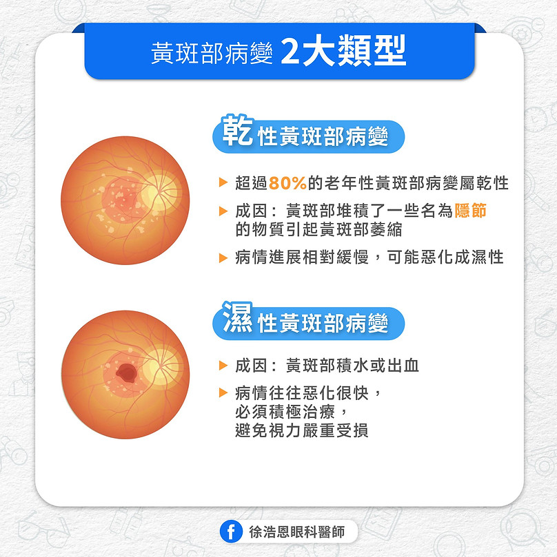 黃斑部-類型.jpg