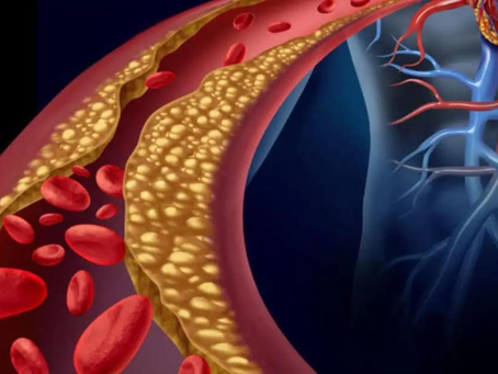 A Distillation of What You Need to Know on Cholesterol