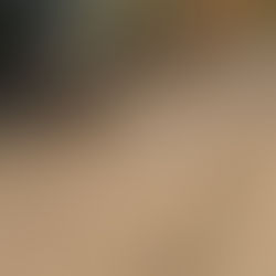 Falta de manutenção em calçamento atrapalha passagem de veículos no Nova Leopoldina