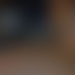 Moradores da Rua Ribeiro Junqueira aguardam troca de lâmpadas