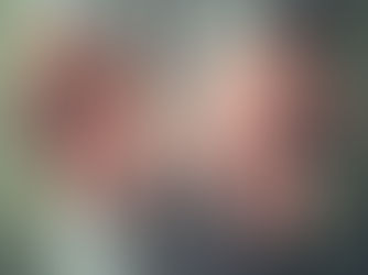 ¡EL DESTINO NOS ALCANZÓ! LLEGÓ EL SARAMPIÓN A PUERTO VALLARTA