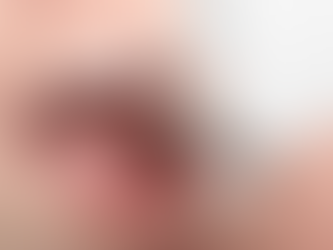 خلع الاسنان للتقويم: متى يكون ضروريًا؟