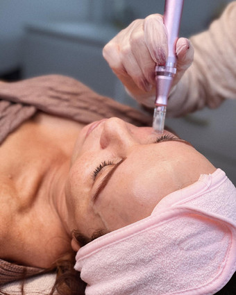 Skin needling