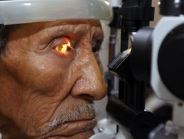 IMSS OTORGA MÁS DE 600 MIL CONSULTAS AL AÑO POR GLAUCOMA