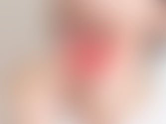 Hashimoto Thyreoiditis und Schilddrüsenkrebs