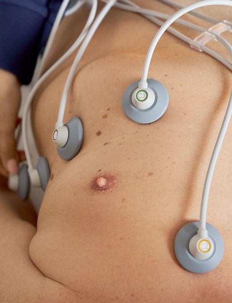 Dr.-Lunow-FibroScan-gesundheitscheck-praxisklinik-checkup-Leberkrebs-fibrose-wegovy-ozempicleber-gesundheitscheck-fettleber