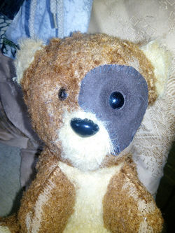 Начало пересадки ворсинок