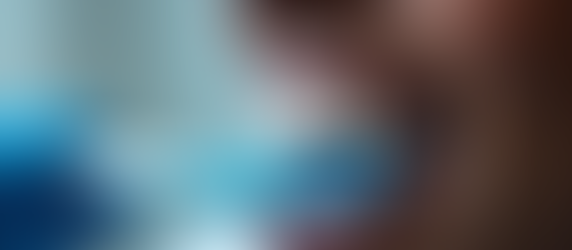 All Your SimplyBrite Teeth Whitening FAQs Answered