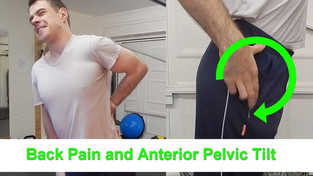 Back Pain and Anterior Pelvic Tilt