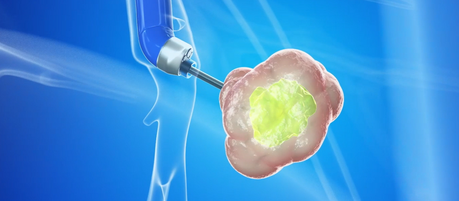 Medical Oncology Courses: Scope and Career Opportunities