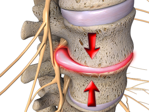 spine.2