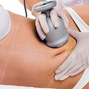 endermologia-2.jpg