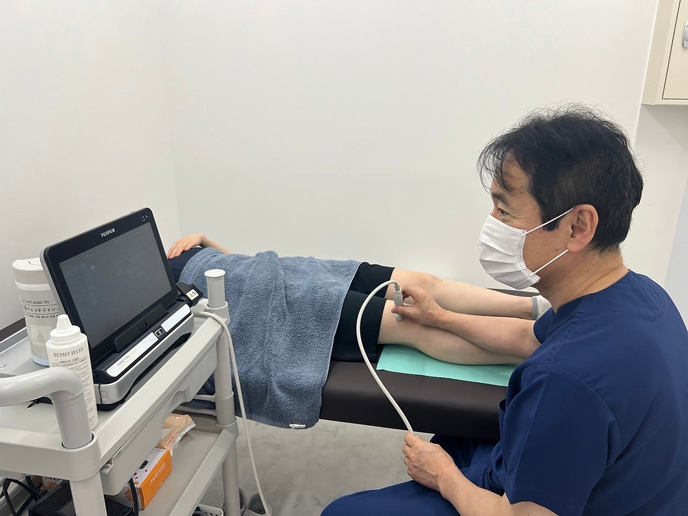  3Dおよび4D超音波