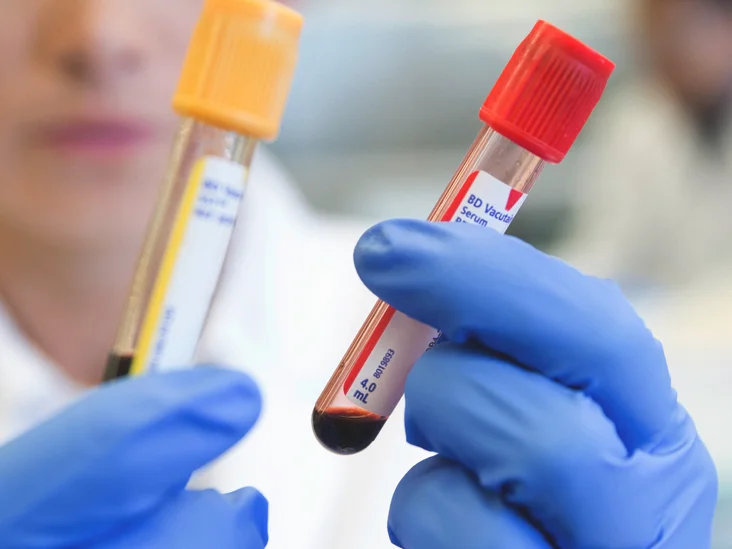How-is-Blood-Drawn-What-to-Expect_732x549-thumbnail.webp