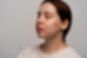 person-dealing-with-rosacea.jpg