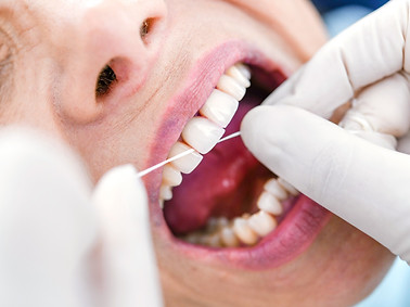 professionelle zahnreinigung und prophylaxe bei zahnarzt dr. beck in pfaffenhofen an der ilm zahnarztpraxis zahnmedizin am loewenbrunnen