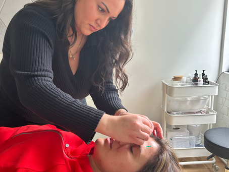 Facial Acupuncture for Anti-Aging & Skin Health