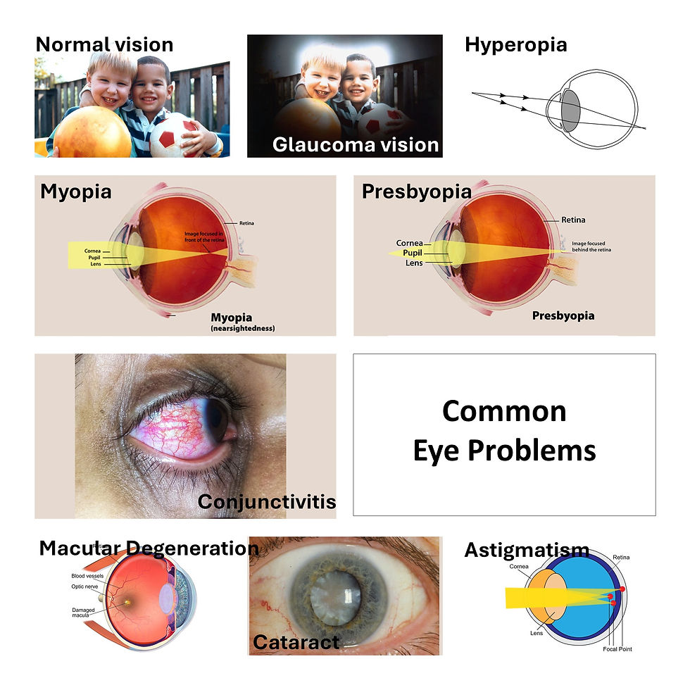 Thumbnail: 20 🇲🇾 MK20 Eyes Care Spray ORGANIC 养眼水 100% Authentic Improve dry eye bag ache