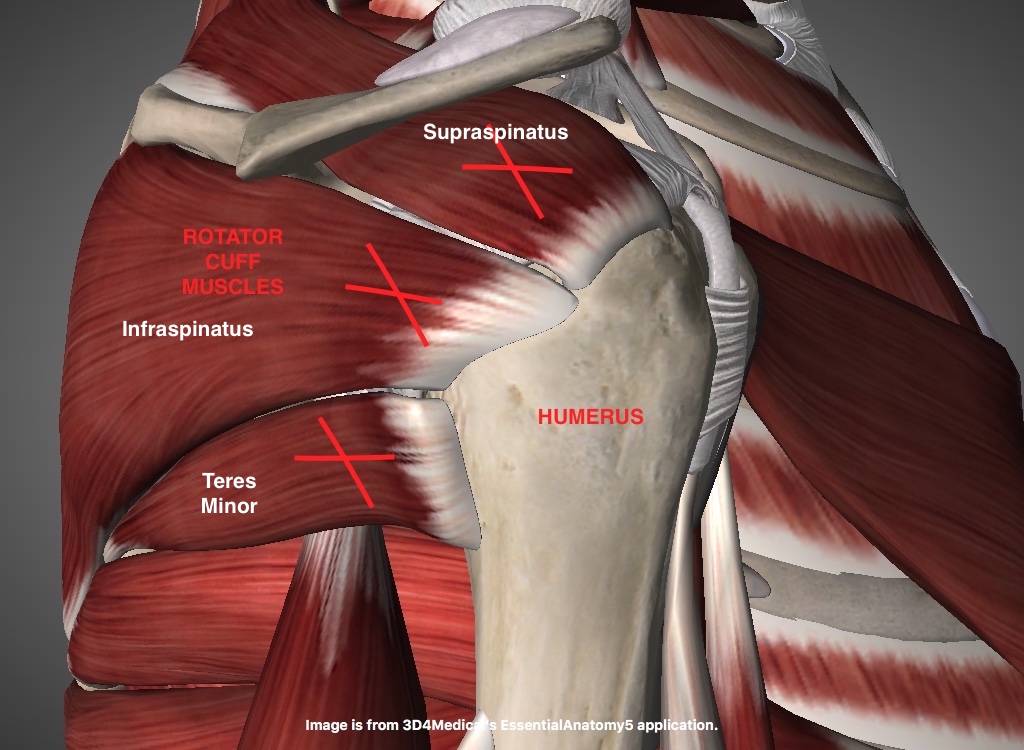 Rotator Cuff Pain Don't Take It Sitting Down CHARM