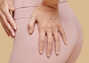 Brazilian butt lift before and after results showing fuller, rounder buttocks and enhanced curves.