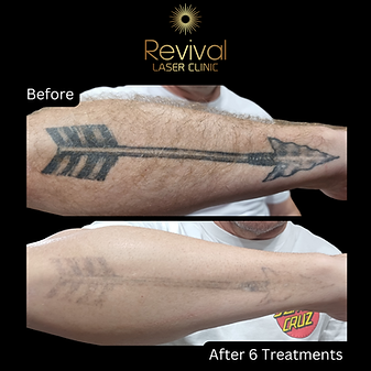 Alex Powell progress pic 2.png