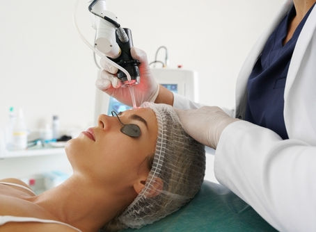 Laser Skin Resurfacing
