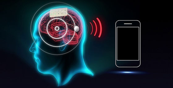 Brain Monitoring Devices Market wills to Grow CAGR of 8.97% during 2018-2022