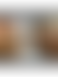 Clearer Skin Starts Here: How Face Reality Can Transform Your Acne Journey