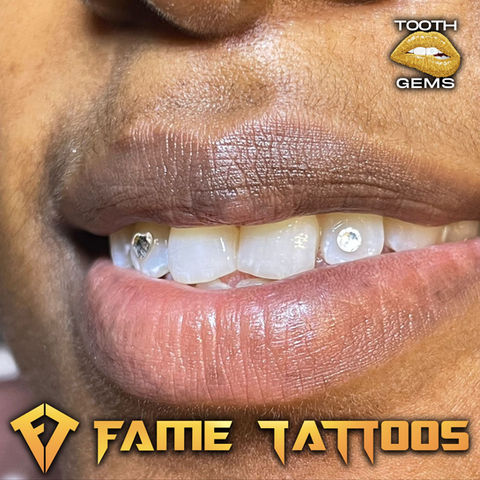 Tooth Gems 15.jpg
