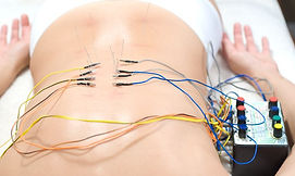 electroacupuncture , camilalanzone , medicinachinesa ,.jpg