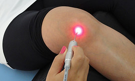 laserterapia , camilalanzone , medicinachinesa.jpg