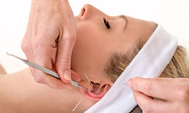 auriculoterapia , auriculopunctura , camilalanzone , medicinachinesa ,.jpg