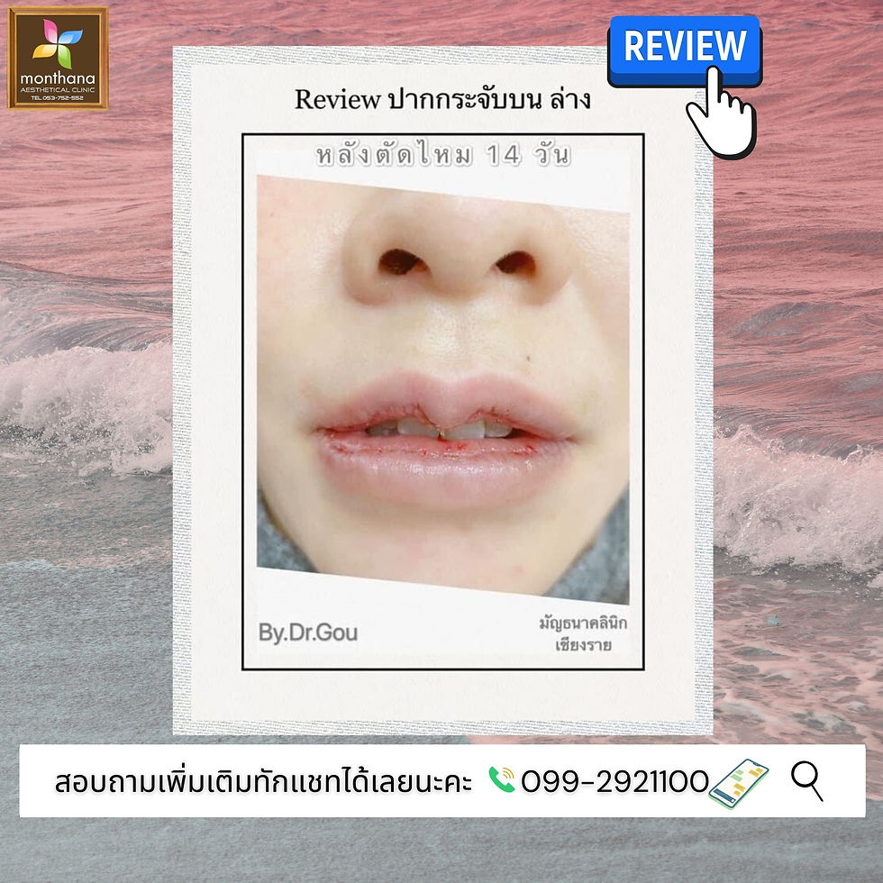 ทำปากกระจับ
