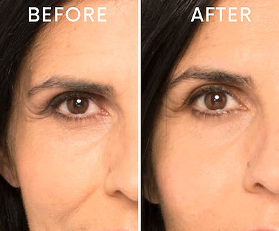 Before after minimal skincare Instagram post_edited.jpg